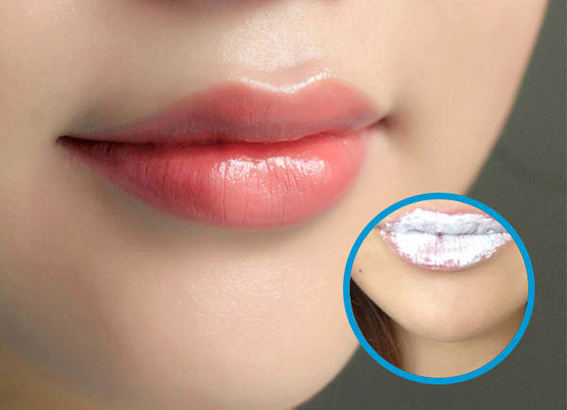 Cách làm môi hết thâm bằng kem đánh răng