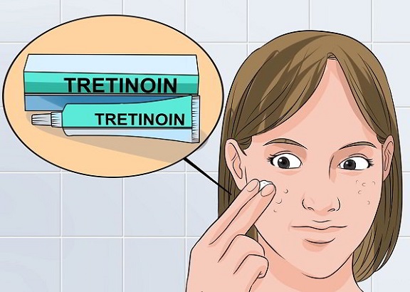 Tretinoin có những tác dụng phụ gì và những người không nên sử dụng thuốc này là ai?
