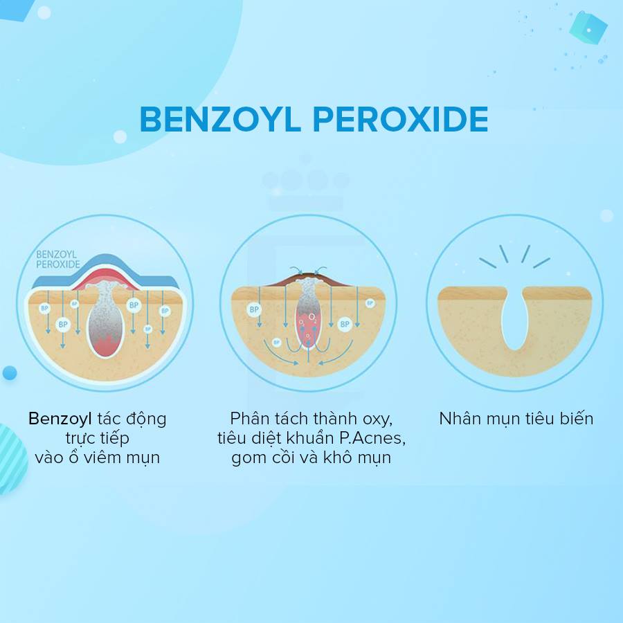 Kem chấm mụn hiệu quả - Benzoyl peroxide