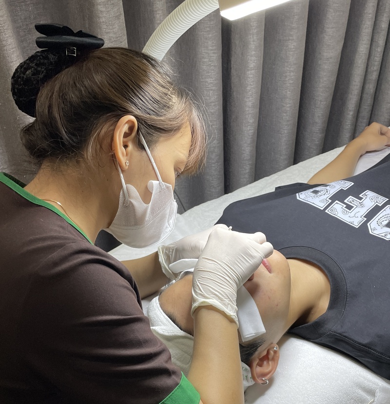 Trị mụn ở Cần Thơ an toàn, hiệu quả tại Hasaki Clinic