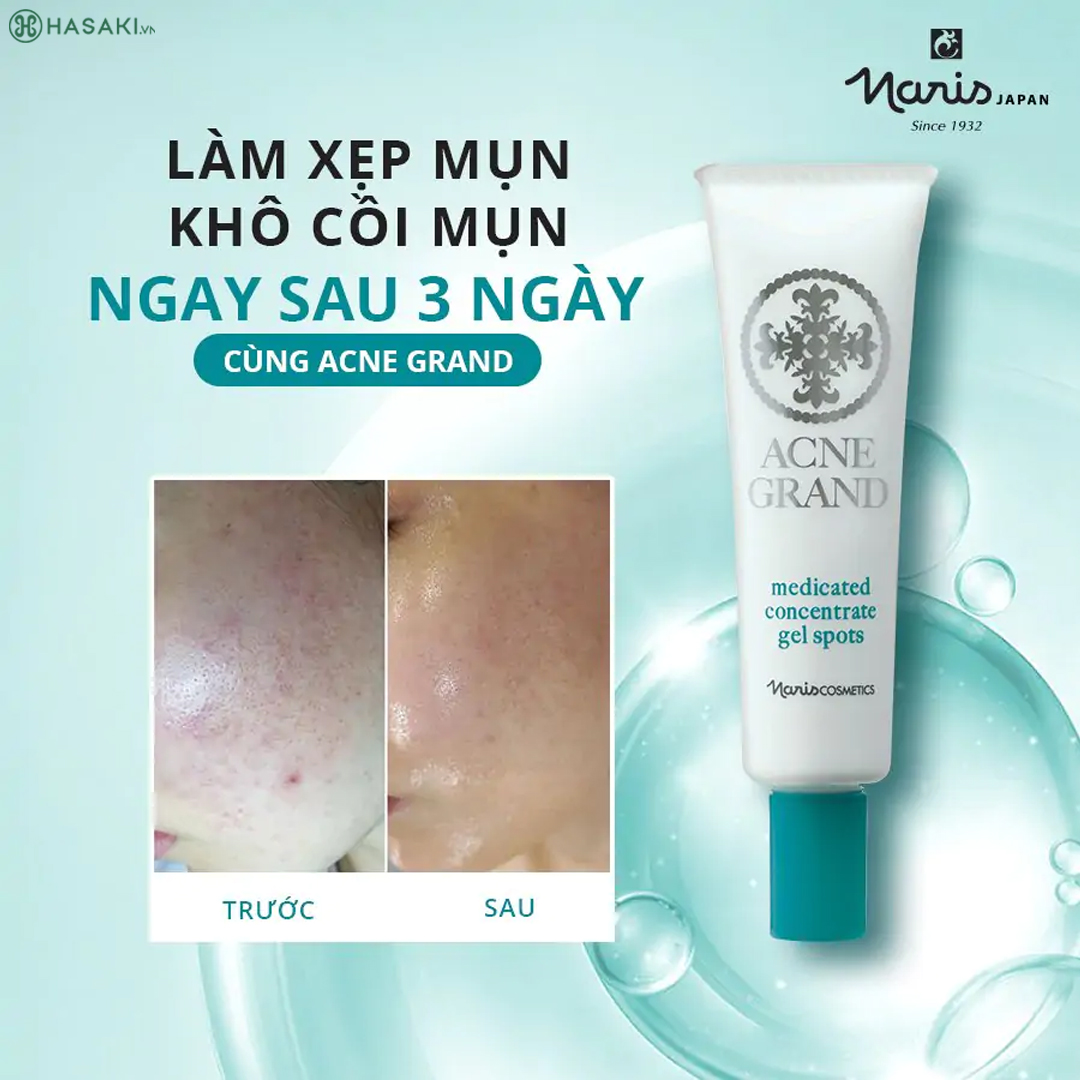 Gel Ngừa Mụn Naris Cosmetic Acne Grand Medicated Concentrate Gel Spots 20g