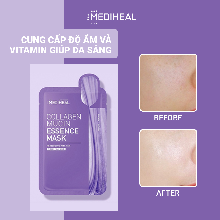 Mặt Nạ Mediheal Collagen Mucin Cải Thiện Nếp Nhăn 20ml