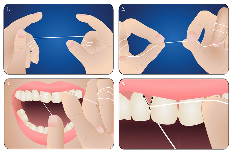 Chỉ Nha Khoa Hương Bạc Hà Jomi Dental Floss Mint dễ dàng sử dụng, an toàn cho răng và nướu.