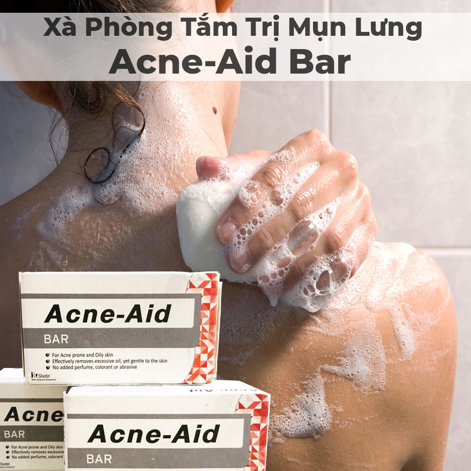 Xà Phòng Acne-Aid Soap Bar loại bỏ bã nhờn, làm sạch sâu và giúp giảm mụn lưng.