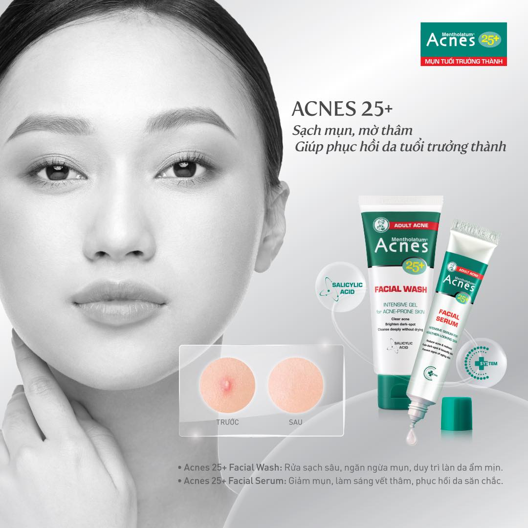 Gel Rửa Mặt Ngăn Ngừa Mụn Acnes 100g Acnes 25+ Facial Wash