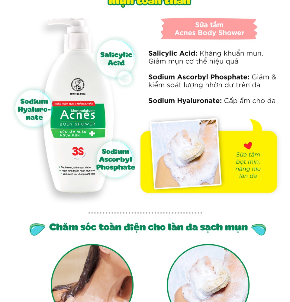 Sữa Tắm Acnes Kiểm Soát Nhờn, Ngăn Ngừa & Giảm Mụn 180g Body Shower