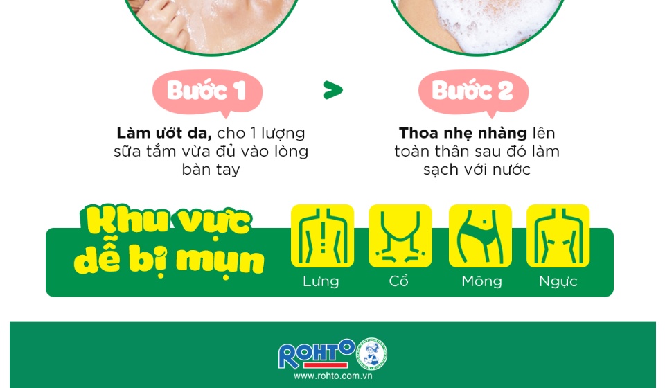 Sữa Tắm Acnes Kiểm Soát Nhờn, Ngăn Ngừa & Giảm Mụn 180g Body Shower rohto nhật bản