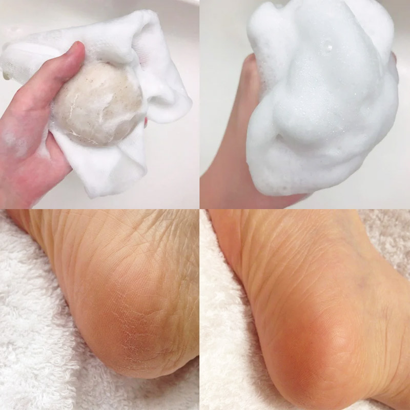 Pelican Fruit Foot Care Soap 80g