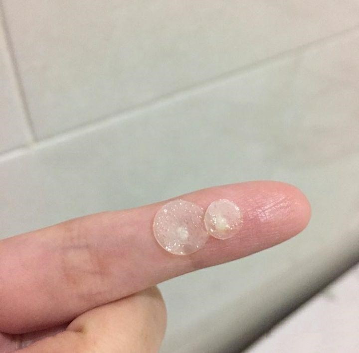 Miếng Dán Mụn Acnes 24 Miếng Clear Patch